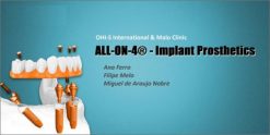 ALL-ON-4 - Implant Prosthetics