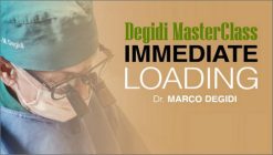Degidi MasterClass, Immediate Loading - Marco Degidi