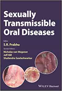 Sexually Transmissible Oral Diseases