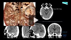 Imaging Acute Stroke: A Comprehensive Review for Clinical Practice