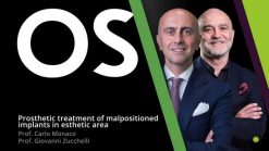Treatment of Malpositioned Implants in the Esthetic Zone