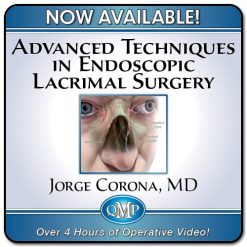 Advanced Techniques in Endoscopic Lacrimal Surgery