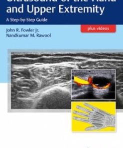 Ultrasound of the Hand and Upper Extremity: A Step-by-Step Guide 1st Edition