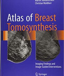 Atlas of Breast Tomosynthesis: Imaging Findings and Image-Guided Interventions 1st ed. 2017 Edition