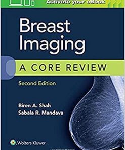 Breast Imaging: A Core Review Second Edition