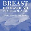 Diagnostic Breast Ultrasound Training Manual: Insights from 150 Case Studies