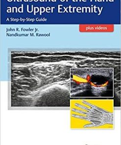 Ultrasound of the Hand and Upper Extremity: A Step-by-Step Guide Pap/Psc Edition