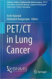 PET/CT in Lung Cancer (Clinicians’ Guides to Radionuclide Hybrid Imaging) 1st ed. 2018 Edition