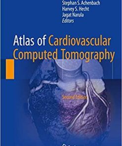 Atlas of Cardiovascular Computed Tomography 2nd ed. 2018 Edition