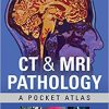 CT & MRI Pathology: A Pocket Atlas, Third Edition 3rd Edition