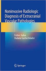 Noninvasive Radiologic Diagnosis of Extracranial Vascular Pathologies 1st ed. 2018 Edition