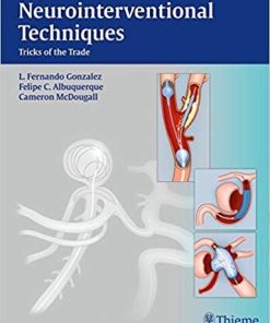 Neurointerventional Techniques: Tricks of the Trade 1st Edition