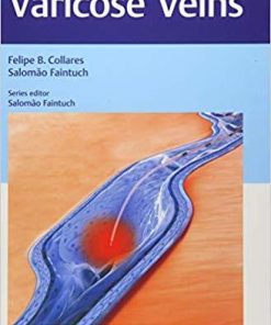 Varicose Veins: Practical Guides in Interventional Radiology 1st Edition