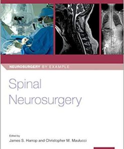 Spinal Neurosurgery (Neurosurgery by Example Book 3) 1st Edition