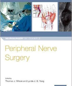 Peripheral Nerve Surgery (Neurosurgery by Example) 1st Edition