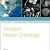 Surgical Neuro-Oncology (Neurosurgery by Example) 1st Edition