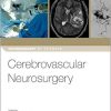 Cerebrovascular Neurosurgery (Neurosurgery by Example)