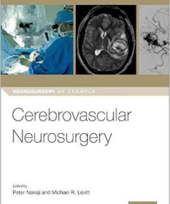 Cerebrovascular Neurosurgery (Neurosurgery by Example)