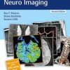 RadCases Plus Q&A Neuro Imaging 2nd Edition