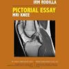 Atlas IRM Rodilla / Pictorial Essay MRI Knee