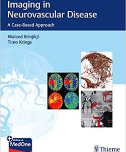 Imaging in Neurovascular Disease: A Case-Based Approach 1st Edition