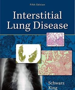 Interstitial Lung Disease