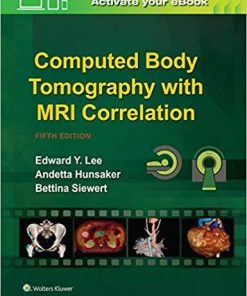 Computed Body Tomography with MRI Correlation Fifth Edition