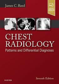 Chest Radiology: Patterns and Differential Diagnoses 7th ed. Edition