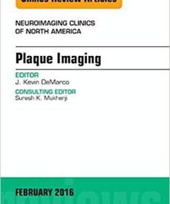 Plaque Imaging, An Issue of Neuroimaging Clinics of North America (The Clinics: Radiology) 1st Edition