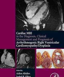 Cardiac MRI in Diagnosis, Clinical Management, and Prognosis of Arrhythmogenic Right Ventricular Cardiomyopathy/Dysplasia 1st Edition