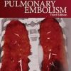 Pulmonary Embolism 3rd Edition