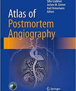 Atlas of Postmortem Angiography 1st ed. 2016 Edition