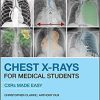 Chest X-Rays for Medical Students: CXRs Made Easy 2nd Edition