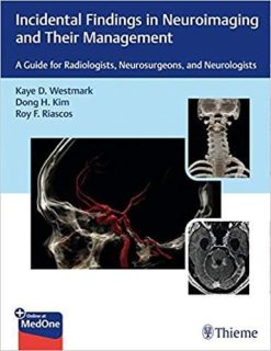1591000672 1585514487 incidental findings in neuroimaging and their management a guide for radiologists neurosurgeons and neurologists 1st edition