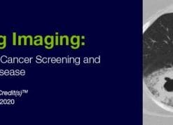 2020 Lung Imaging Highlighting Lung Cancer Screening and Interstitial Lung Disease (CME VIDEOS)