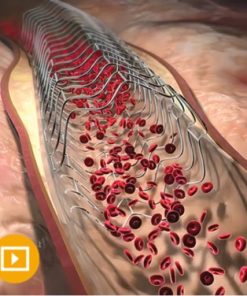 Comprehensive Review of Interventional Cardiology 2023