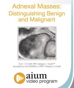 AIUM Adnexal Masses: Distinguishing Benign and Malignant (CME VIDEOS)