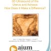 AIUM 3D Ultrasound of the Uterus and Adnexa: How Does it Make a Difference? (CME VIDEOS)