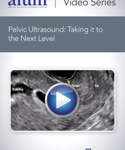 AIUM Pelvic Ultrasound: Taking it to the Next Level (CME VIDEOS)