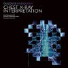 Discover Radiology Chest X-Ray Interpretation : Book for Medical Student (PDF)