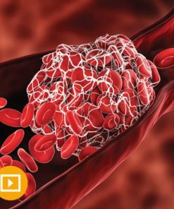 Thrombosis & Thromboembolism 2022 (CME VIDEOS)