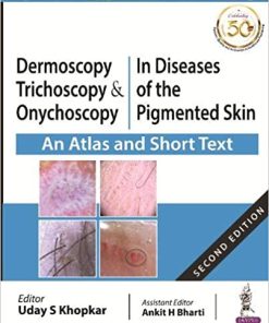 Dermoscopy, Trichoscopy & Onychoscopy In Diseases of the Pigmented Skin An Atlas and Short Text (PDF)