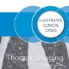 Thoracic Imaging: Illustrated Clinical Cases, Second Edition