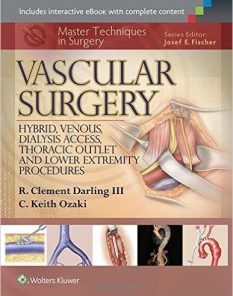 Master Techniques in Surgery: Vascular Surgery: Hybrid, Venous, Dialysis Access, Thoracic Outlet, and Lower Extremity Procedures (EPUB)