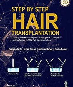 Step by Step Hair Transplantation (PDF)