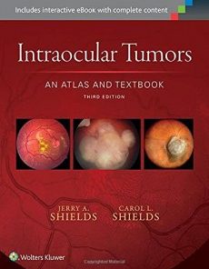 Intraocular Tumors: An Atlas and Textbook (High Quality CHM)