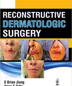 Reconstructive Dermatologic Surgery (PDF)