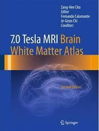 7.0 Tesla MRI Brain White Matter Atlas