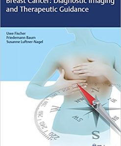 Breast Cancer: Diagnostic Imaging and Therapeutic Guidance (EPUB)