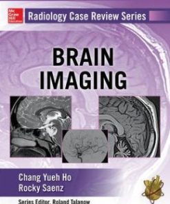 Radiology Case Review Series: Brain Imaging (PDF)